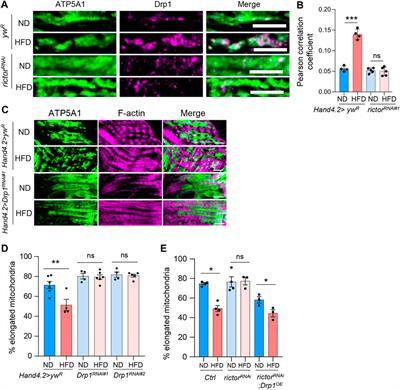 mTORC2 protects the heart from high-fat diet-induced cardiomyopathy through mitochondrial fission in Drosophila